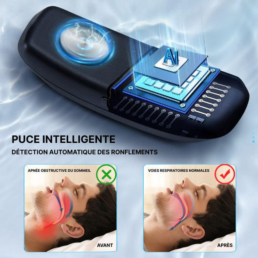 Appareil Anti Ronflement SleepEase™️